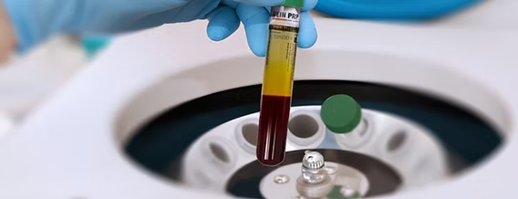 5,000,000 bloody nickels